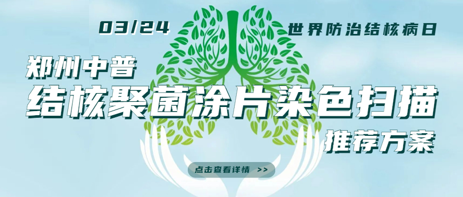 NOPAYǮ�� - ��ȫ��ݵ��ֻ�֧��Ǯ������